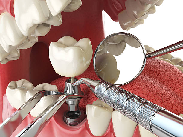 Best Cracked Tooth Emergency Dentist  in Rockvale, TN