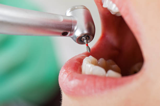 Best Cracked Tooth Emergency Dentist  in Rockvale, TN